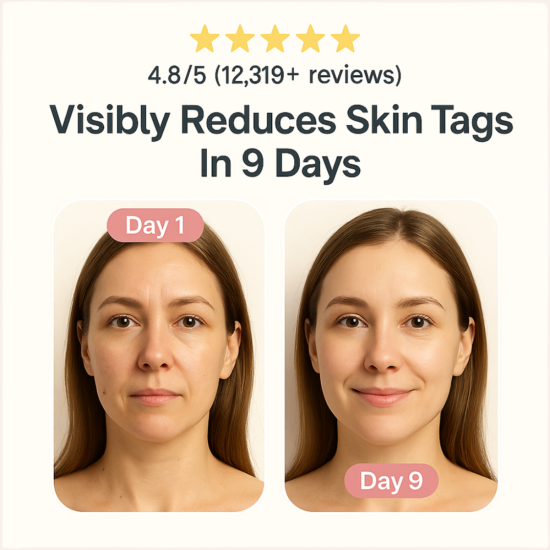 FUGHAZI™ Auto Skin Tag Remover